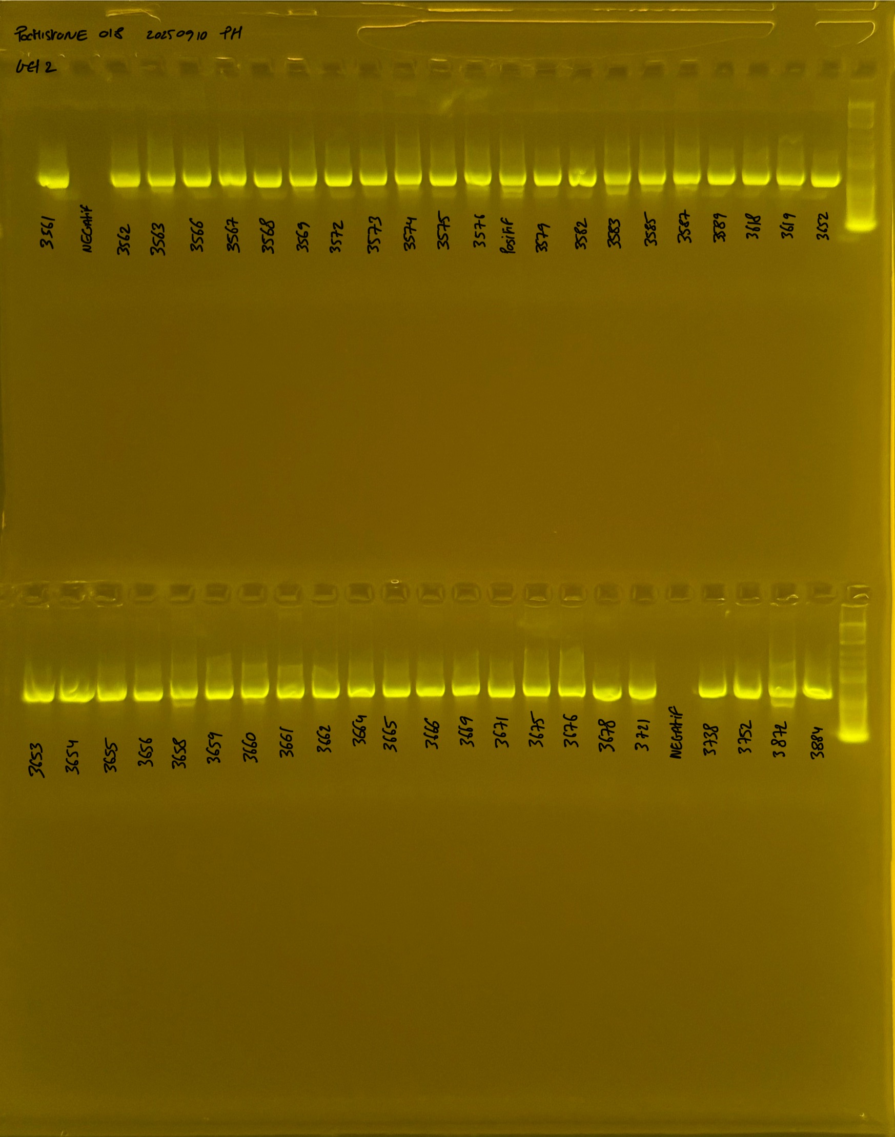 PocHistone_018_g2_20250910.JPG