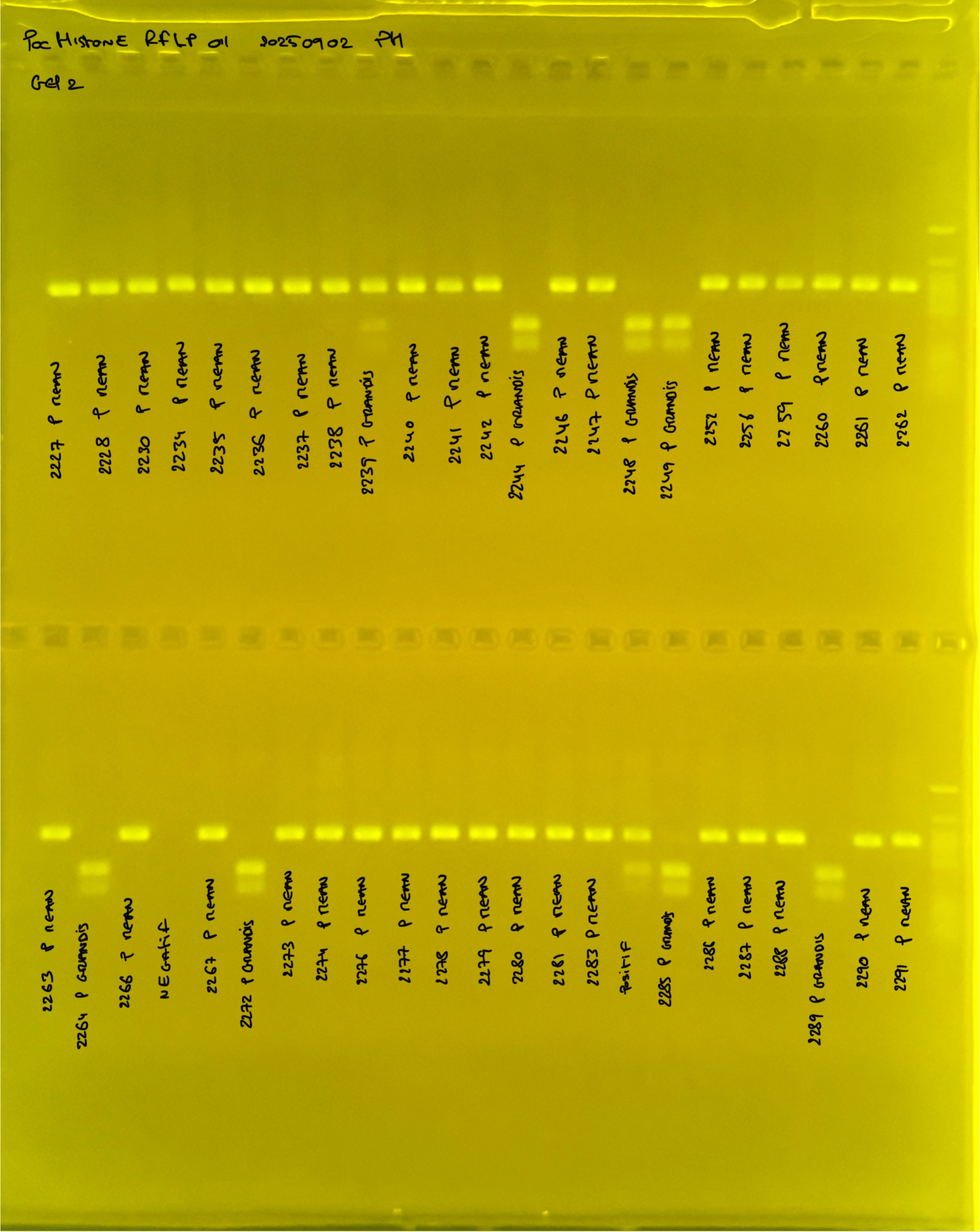 PocHistone_RFLP_011_g2_20250902.JPG