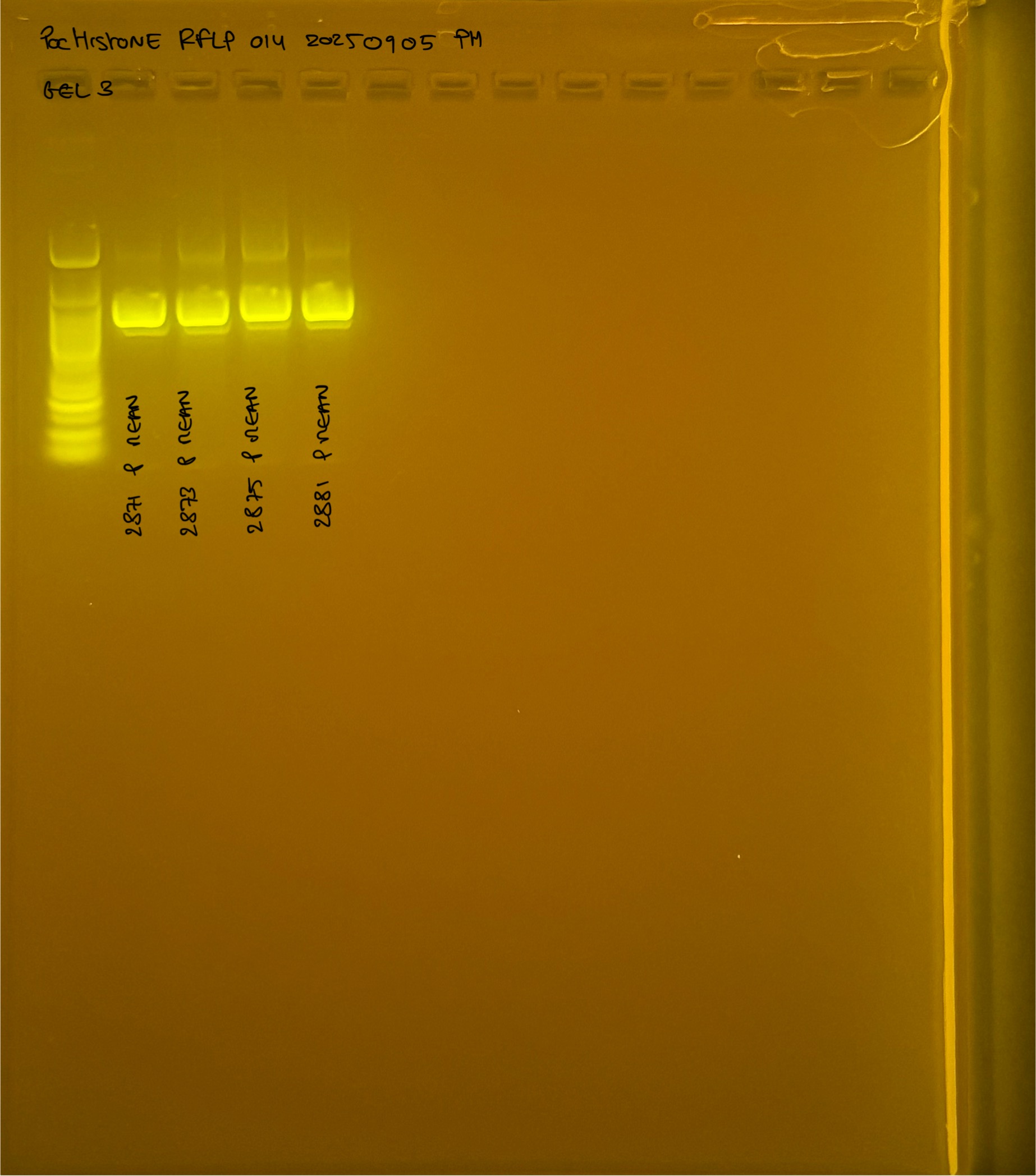 PocHistone_RFLP_014_g3_20250905.JPG